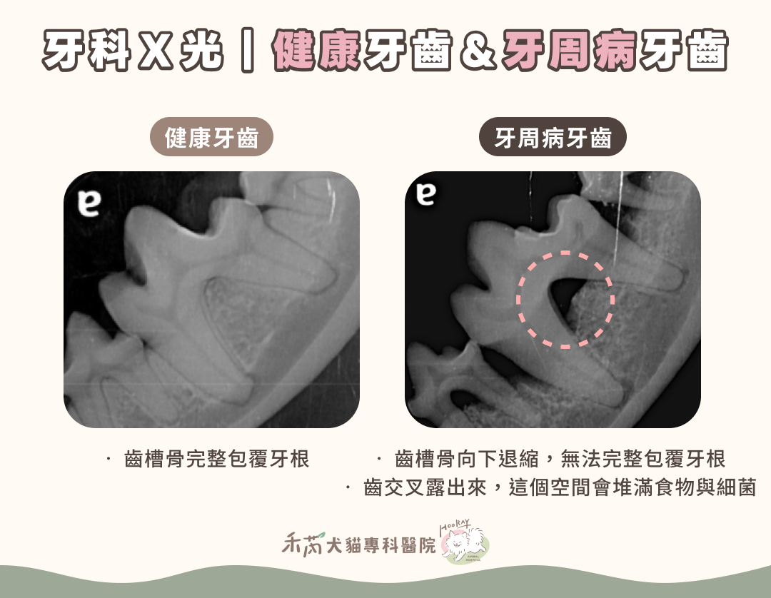 牙科x光圖