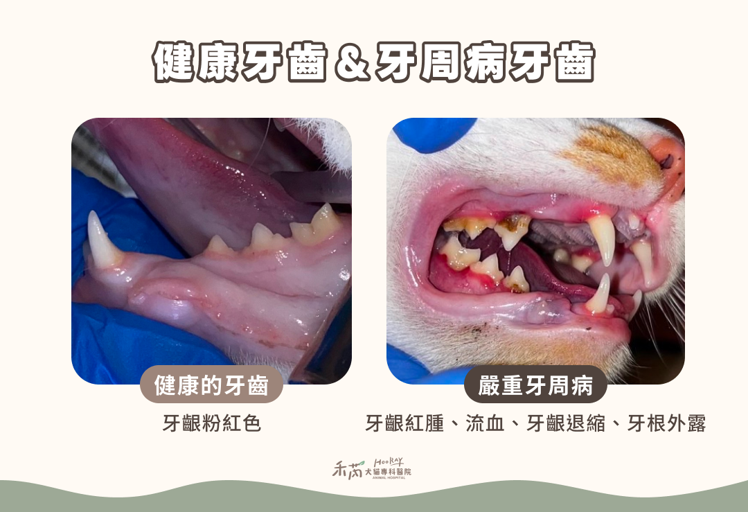 健康牙齒＆牙周病牙齒