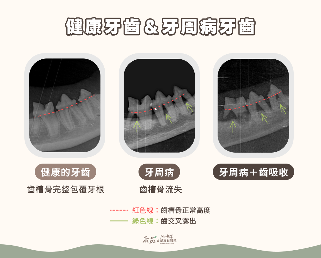 健康牙齒＆牙周病牙齒2